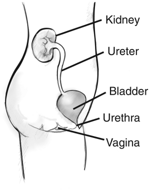 Side view diagram of the female urinary tract. Labels point to the kidney, ureter, bladder, urethra, and vagina.The organs appear within the outline of a young female shown from the abdomen to the thigh.